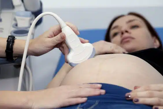 אישה בהריון עושה בדיקת אולטרסאונד